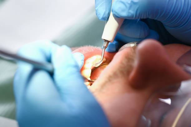 Best Weekend Emergency Dentist in Colma, CA