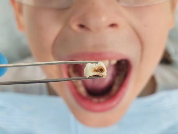 Best Emergency Dental Surgery in Colma, CA